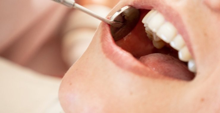 DOSPU convoca a cubrir vacante en odontología